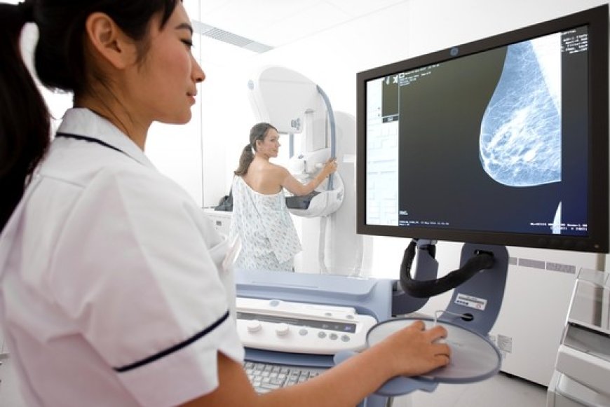 FDA Updates Mammogram Recommendations: What Changes You Need To Know
