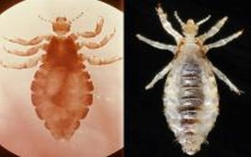 "Body Lice: Everything You Need To Know About These Tiny Parasites"