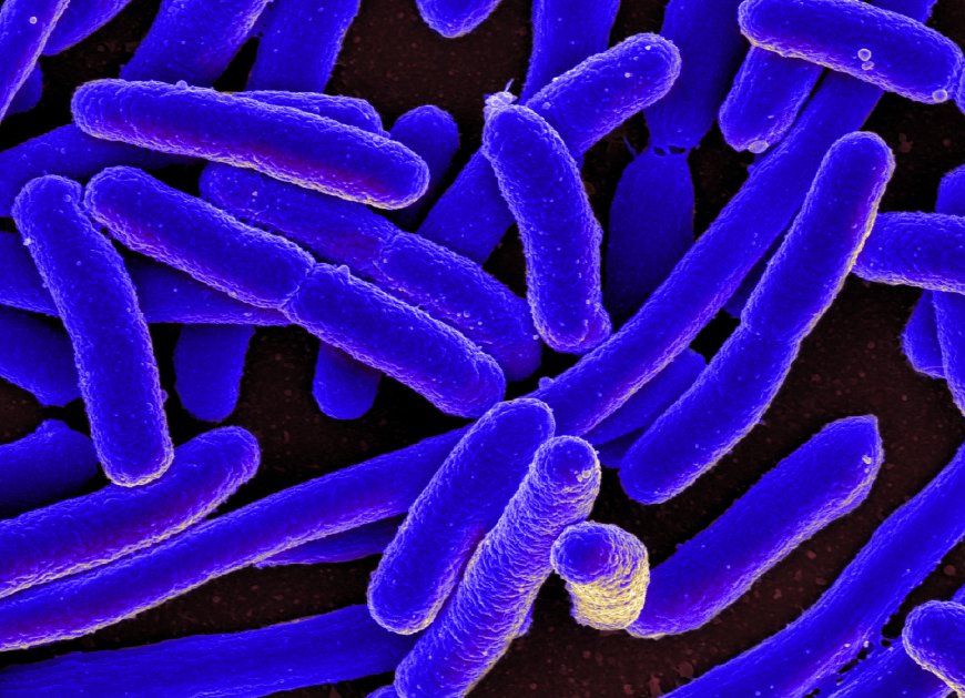 All You Need to Know About E.coli Infection