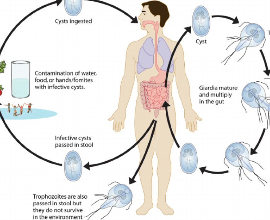 How To Recognize And Treat Giardiasis